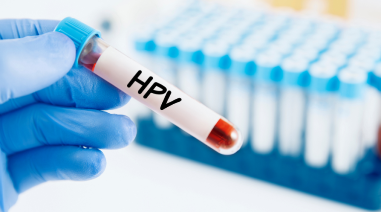 Xét nghiệm HPV định kỳ để biết người chưa quan hệ có bị nhiễm HPV hay không