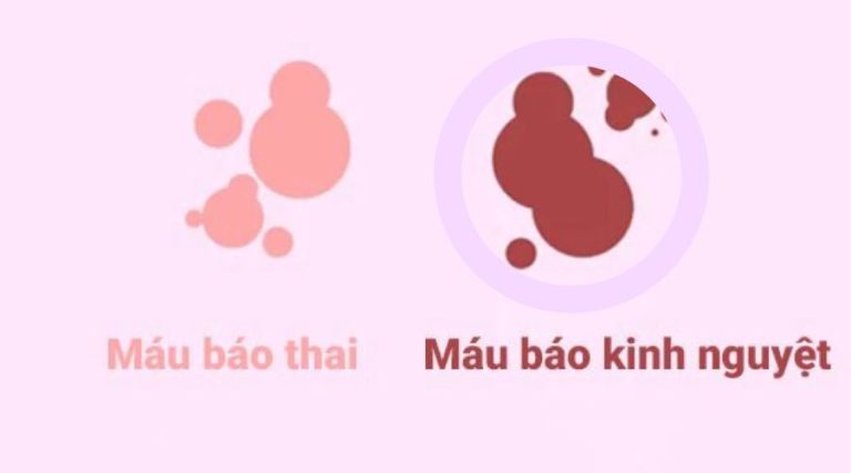 máu báo thai xuất hiện sau khi chậm kinh bao lâu?