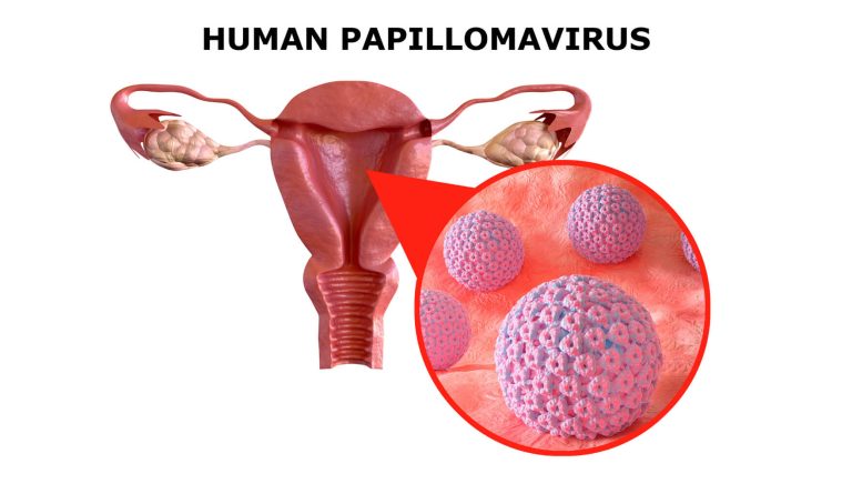 Virus HPV gây ung thư cổ tử cung phổ biến ở phụ nữ hiện nay